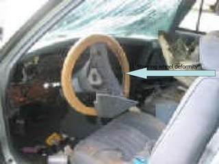 Steering wheel deformity 