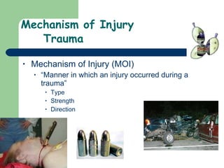Mechanism of Injury Trauma Mechanism of Injury (MOI) “Manner in which an injury occurred during a trauma” Type Strength Direction 