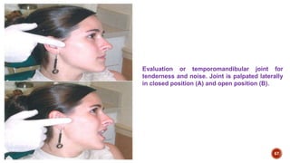 Lecture 9 TMJ anatomy examination | PPTX