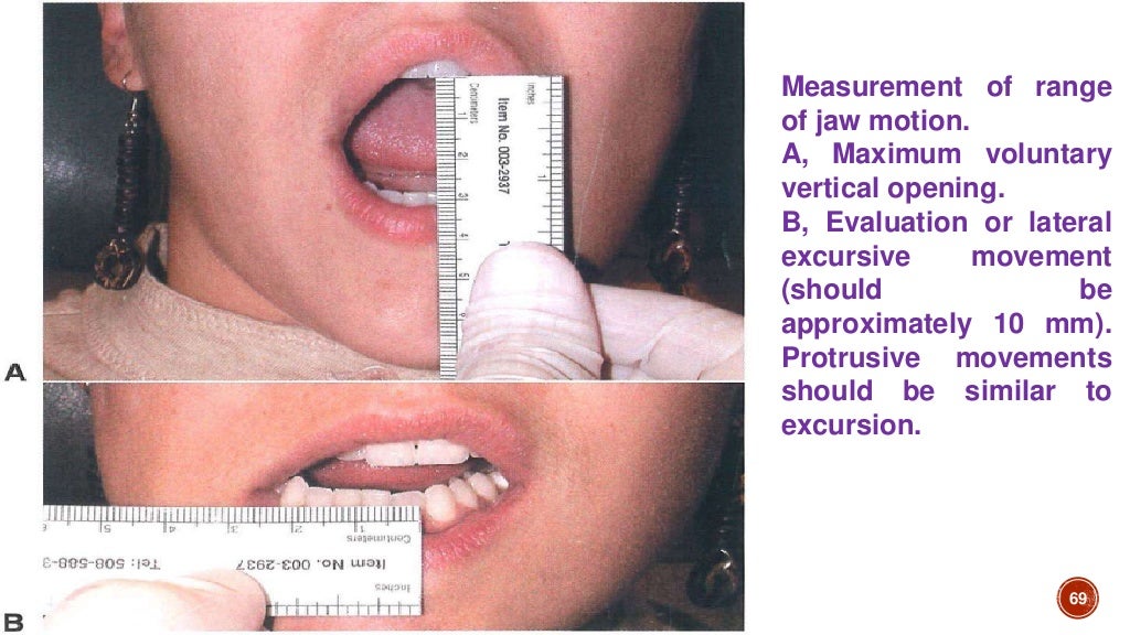 Lecture 9 TMJ anatomy examination