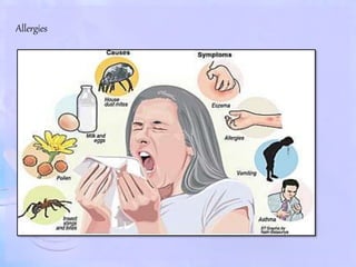 Allergies
 