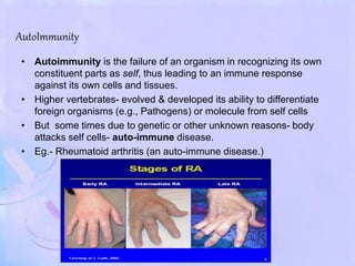 AutoImmunity
• Autoimmunity is the failure of an organism in recognizing its own
constituent parts as self, thus leading to an immune response
against its own cells and tissues.
• Higher vertebrates- evolved & developed its ability to differentiate
foreign organisms (e.g., Pathogens) or molecule from self cells
• But some times due to genetic or other unknown reasons- body
attacks self cells- auto-immune disease.
• Eg.- Rheumatoid arthritis (an auto-immune disease.)
 