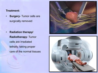 Treatment:
• Surgery- Tumor cells are
surgically removed
• Radiation therapy/
Radiotherapy- Tumor
cells are irradiated
lethally, taking proper
care of the normal tissues
 