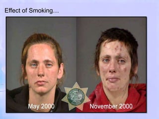 Effect of Smoking…
 