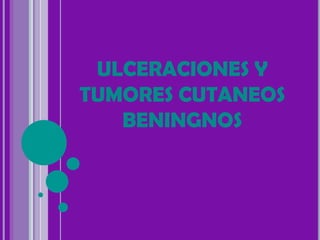 ULCERACIONES Y
TUMORES CUTANEOS
   BENINGNOS
 