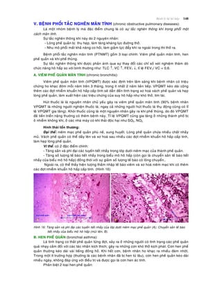Beänh lyù heä hoâ haáp 148
V. BEÄNH PHOÅI TAÉC NGHEÕN MAÕN TÍNH (chronic obstructive pulmonary diseases):
Laø moät nhoùm beänh lyù maø ñaëc ñieåm chung laø coù söï taéc ngheõn thoâng khí trong phoåi moät
caùch maõn tính.
Söï taéc ngheõn thoâng khí naøy do 2 nguyeân nhaân:
- Loøng pheá quaûn bò thu heïp, laøm taêng khaùng löïc ñöôøng thôû.
- Nhu moâ phoåi maát khaû naêng co hoài, laøm giaûm löïc ñaåy khí ra ngoaøi trong thì thôû ra.
Beänh phoåi taéc ngheõn maõn tính (PTNMT) goàm 3 loaïi chính: Vieâm pheá quaûn maõn tính, hen
pheá quaûn vaø khí pheá thuõng.
Söï taéc ngheõn thoâng khí ñöôïc phaûn aùnh qua söï thay ñoåi caùc chæ soá xeùt nghieäm thaêm doø
chöùc naêng hoâ haáp so vôùi bình thöôøng nhö: TLC , VC , FEV1 , tæ leä FEV1/ VC < 0,6.
A. VIEÂM PHEÁ QUAÛN MAÕN TÍNH (chronic bronchitis):
Vieâm pheá quaûn maõn tính (VPQMT) ñöôïc xaùc ñònh treân laâm saøng khi beänh nhaân coù trieäu
chöùng ho khaïc ñôøm moãi naêm treân 3 thaùng, trong ít nhaát 2 naêm lieân tieáp. VPQMT keùo daøi coäng
theâm caùc ñôït nhieãm khuaån hoâ haáp caáp tính seõ daãn ñeán tình traïng xô hoaù vaùch pheá quaûn vaø heïp
loøng pheá quaûn, laøm xuaát hieän caùc trieäu chöùng cuûa suy hoâ haáp nhö khoù thôû, tím taùi.
Huùt thuoác laù laø nguyeân nhaân chuû yeáu gaây ra vieâm pheá quaûn maõn tính (90% beänh nhaân
VPQMT laø nhöõng ngöôøi nghieän thuoác laù; ngay caû nhöõng ngöôøi huùt thuoác laù thuï ñoäng cuõng coù tæ
leä VPQMT gia taêng). Khoùi thuoác cuõng laø moät nguyeân nhaân gaây ra khí pheá thuõng, do ñoù VPQMT
ñaõ tieán trieån naëng thöôøng coù theâm beänh naøy. Tæ leä VPQMT cuõng gia taêng ôû nhöõng thaønh phoá bò
oâ nhieãm khoâng khí, ôû caùc nhaø maùy coù khí thaûi ñoäc haïi nhö SO2, NO2.
Hình thaùi toån thöông:
Ñaïi theå: nieâm maïc pheá quaûn phuø neà, sung huyeát. Loøng pheá quaûn chöùa nhieàu chaát nhaày
muû. Vaùch pheá quaûn coù theå daày leân vaø xô hoaù sau nhieàu caùc ñôït nhieãm khuaån hoâ haáp caáp tính,
laøm heïp loøng pheá quaûn.
Vi theå: coù 2 ñaëc ñieåm chính:
- Taêng saûn vaø phì ñaïi caùc tuyeán tieát nhaày trong lôùp döôùi nieâm maïc cuûa thaønh pheá quaûn.
- Taêng soá löôïng teá baøo tieát nhaày trong bieåu moâ hoâ haáp (coøn goïi laø chuyeån saûn teá baøo tieát
nhaày cuûa bieåu moâ hoâ haáp) ñoàng thôøi vôùi söï giaûm soá löôïng teá baøo coù loâng chuyeån…
Ngoaøi ra, coù theå thaáy hieän töôïng thaám nhaäp teá baøo vieâm vaø xô hoaù nieâm maïc khi coù theâm
caùc ñôït nhieãm khuaån hoâ haáp caáp tính. (Hình 16)
Hình 16: Taêng saûn vaø phì ñaïi caùc tuyeán tieát nhaày cuûa lôùp döôùi nieâm maïc pheá quaûn (A); Chuyeån saûn teá baøo
tieát nhaày cuûa bieåu moâ hoâ haáp (muõi teân, B).
B. HEN PHEÁ QUAÛN (bronchial asthma):
Laø tình traïng co thaét pheá quaûn töøng ñôït, xaûy ra ôû nhöõng ngöôøi coù tình traïng caùc pheá quaûn
quaù nhaïy caûm ñoái vôùi caùc taùc nhaân kích thích; gaây ra nhöõng côn khoù thôû kòch phaùt. Côn hen pheá
quaûn thöôøng keùo daøi vaøi tieáng ñoàng hoà. Khi heát côn, beänh nhaân ho khaïc ra nhieàu ñaøm nhôùt.
Trong moät ít tröôøng hôïp (thöôøng laø caùc beänh nhaân ñaõ bò hen töø laâu), côn hen pheá quaûn keùo daøi
nhieàu ngaøy, khoâng ñaùp öùng vôùi ñieàu trò vaø ñöôïc goïi laø côn hen aùc tính.
Phaân bieät 2 loaïi hen pheá quaûn:
 