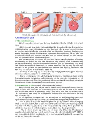 Beänh Lyù OÁng Tieâu Hoùa 179
Hình 25 : Boán nguyeân nhaân chính gaây taéc ruoät: thoaùt vò, dính ruoät, loàng ruoät, xoaén ruoät
IV. NHOÙM BEÄNH LYÙ VIEÂM
1. Vieâm ruoät nhieãm truøng
Laø tình traïng vieâm ruoät non hoaëc ñaïi traøng do caùc taùc nhaân nhö vi khuaån, viruùt, kyù sinh
truøng.
- Beänh vieâm ruoät do vi khuaån thöôøng gaây tieâu chaûy, laø nguyeân nhaân gaây töû vong cho hôn
12.000 tröôøng hôïp treû em moãi ngaøy taïi caùc nöôùc ñang phaùt trieån. Vi khuaån vaøo ruoät theo thöùc
aên; coù nhieàu loaïi vi khuaån gaây beänh khaùc nhau nhö Clostridium botulinum, Staphylococcus
aureus, Salmonella, Shigella, Mycobacterium tuberculosis, Escherichia coli… Ñeå gaây vieâm ruoät,
vi khuaån phaûi coù khaû naêng baùm dính hoaëc xaâm nhaäp vaøo trong teá baøo bieåu moâ nieâm maïc ruoät
hoaëc saûn xuaát ra ñoäc toá ñoái vôùi ruoät (enterotoxin).
Hình thaùi vaø vò trí toån thöông thay ñoåi khaùc nhau tuøy loaïi vi khuaån gaây beänh. Toån thöông
ñaïi theå thöôøng gaëp goàm coù tình traïng nieâm maïc phuø neà sung huyeát ñoû, coù theå coù loeùt saâu, ñoùng
giaû maïc thaäm chí thuûng ruoät (nhö trong nhieãm Salmonella typhi gaây beänh thöông haøn). Trong
vieâm ruoät do Mycobacterium tuberculosis, coù söï hình thaønh caùc u haït lao trong lôùp nieâm maïc.
Veà vi theå, coù theå gaëp hình aûnh vieâm caáp tính hoaëc maõn tính nieâm maïc ruoät, caùc teá baøo vieâm
thaám nhaäp vaøo trong moâ ñeäm vaø lôùp bieåu moâ beà maët.
- Vieâm ruoät do viruùt cuõng gaây tieâu chaûy. Caùc loaïi viruùt gaây beänh thöôøng gaëp laø Rotavirus,
adenovirus, calicivirus, astrovirus vaø viruùt Norwalk.
- Caùc kyù sinh truøng gaây vieâm ruoät thöôøng gaëp laø Entamoeba histolytica vaø Giardia lamblia.
Entamoeba histolytica chui vaøo loøng tuyeán Lieberkühn cuûa ñaïi traøng, xaâm nhaäp vaø phaù huûy moâ
ñeäm nieâm maïc, taïo ra caùc oå loeùt hình chai thoùt coå, beân trong chöùa chaát hoaïi töû maàu naâu soâcoâla.
Giardia lamblia thì baùm dính vaø gaây toån thöông nieâm maïc ruoät non.
2. Beänh vieâm ruoät voâ caên (idiopathic inflammatory bowel disease):
Beänh Crohn vaø beänh vieâm loeùt ñaïi traøng laø 2 beänh tuy coù hình thaùi toån thöông khaùc bieät
nhöng laïi gioáng nhau ôû choã ñeàu gaây ra tình traïng vieâm ruoät maõn tính, taùi ñi taùi laïi maø nguyeân
nhaân thì chöa ñöôïc bieát; do ñoù ngöôøi ta goïi chung 2 beänh naøy laø beänh vieâm ruoät voâ caên (VRVC).
Caû 2 beänh ñeàu coù theâm nhöõng toån thöông vieâm ôû nhieàu cô quan khaùc ngoaøi ruoät vaø laøm taêng
nguy cô ung thö ruoät.
Cô cheá beänh sinh cuûa beänh VRVC cho ñeán nay vaãn coøn ñang trong voøng nghieân cöùu.
Ngöôøi ta cho raèng coù söï taùc ñoäng cuûa nhieàu yeáu toá khaùc nhau trong cô cheá phaùt sinh beänh:
- Yeáu toá cô ñòa di truyeàn deã maéc beänh: phaûn aùnh qua söï xuaát hieän nhöõng tröôøng hôïp
VRVC coù tính chaát gia ñình, 15% soá beänh nhaân VRVC coù theâm 1 thaønh vieân khaùc trong gia ñình
cuøng maéc beänh. Nhö vaäy, yeáu toá naøy coù theå lieân quan ñeán moät soá thay ñoåi veà gen khieán cho
ruoät trôû neân nhaïy caûm, deã bò toån thöông bôûi vi khuaån, ñoäc toá hoaëc ñaùp öùng mieãn dòch.
- Yeáu toá nhieãm khuaån: söï nhieãm caùc vi khuaån nhö Chlamydia, Mycobacterium
paratuberculosis coù theå giöõ vai troø khôûi phaùt tình traïng vieâm maõn tính; caùc BCÑNTT, BCÑN aùi
toan, limphoâ baøo vaø ñaïi thöïc baøo ñöôïc thu huùt vaø hoaït hoùa, giaûi phoùng caùc chaát trung gian hoùa
hoïc gaây toån thöông nieâm maïc ruoät.
 