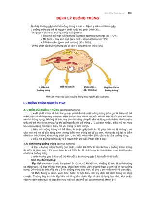 228Beänh lyù heä Sinh duïc nöõ
BEÄNH LYÙ BUOÀNG TRÖÙNG
Beänh lyù thöôøng gaëp nhaát ôû buoàng tröùng laø caùc u. Beänh lyù vieâm raát hieám gaëp.
U buoàng tröùng coù theå laø nguyeân phaùt hoaëc thöù phaùt (Hình 33).
- U nguyeân phaùt cuûa buoàng tröùng xuaát phaùt töø:
+ Bieåu moâ beà maët buoàng tröùng (surface epithelial tumors) (65 - 70%)
+ Moâ ñeäm – daây sinh duïc (sex cord – stromal tumors) (10%)
+ Teá baøo maàm (germ cell tumors) (15 - 20%)
- U thöù phaùt cuûa buoàng tröùng: do di caên töø ung thö nôi khaùc (5%)
Hình 33: Phaân loaïi caùc u buoàng tröùng theo nguoàn goác xuaát phaùt
I. U BUOÀNG TRÖÙNG NGUYEÂN PHAÙT
A. U BIEÅU MOÂ BUOÀNG TRÖÙNG (epithelial tumors):
U xuaát phaùt töø lôùp teá baøo trung maïc phuû treân beà maët buoàng tröùng (coøn goïi laø bieåu moâ beà
maët) hoaëc töø nhöõng nang trong moâ ñeäm (ñöôïc hình thaønh do bieåu moâ beà maët bò vuøi vaøo moâ ñeäm
sau khi tröùng ruïng). Nhöõng teá baøo naøy coù khaû naêng chuyeån saûn vaø taêng sinh thaønh nhieàu loaïi u
bieåu moâ beà maët khaùc nhau, coù theå gioáng bieåu moâ coå trong CTC (u dòch nhaày), bieåu moâ noäi maïc
töû cung (u daïng noäi maïc), bieåu moâ voøi tröùng (u dòch trong).
U bieåu moâ buoàng tröùng coù theå laønh, aùc hoaëc giaùp bieân aùc. U giaùp bieân aùc laø nhöõng u coù
caáu truùc moâ vaø teá baøo taêng sinh khoâng ñieån hình troâng coù veû aùc tính, nhöng ña soá laïi coù dieãn
tieán laønh tính, khoâng xaâm nhaäp vaø di caên. U aùc bieåu moâ chieám 90% caùc u aùc cuûa buoàng tröùng.
U bieåu moâ buoàng tröùng xaûy ra ôû ngöôøi treân 20 tuoåi. Phaân bieät 5 loaïi:
1. U dòch trong buoàng tröùng (serous tumors):
Laø loaïi u buoàng tröùng thöôøng gaëp nhaát, chieám 20-50% taát caû caùc loaïi u buoàng tröùng; trong
ñoù 60% laø laønh tính, 15% giaùp bieân aùc vaø 25% aùc. U dòch trong aùc tính laø loaïi u aùc thöôøng gaëp
nhaát cuûa buoàng tröùng.
U laønh thöôøng gaëp ôû löùa tuoåi 30-40 tuoåi, u aùc thöôøng gaëp ôû löùa tuoåi 45-65 tuoåi.
Hình thaùi toån thöông:
- Ñaïi theå: u coù kích thöôùc trung bình 5-10 cm, coù khi raát lôùn, khoaûng 30 cm. U laønh thöôøng
coù daïng boïc, voû boïc moûng, trôn laùng, chöùa dòch trong. 25% tröôøng hôïp u laønh coù ôû hai buoàng
tröùng. Ñoái vôùi u aùc tính, tæ leä coù u ôû hai buoàng tröùng cao hôn, voû boïc u coù nhieàu nhuù vaø ñaùm ñaëc.
-Vi theå: Trong u laønh, vaùch boïc ñöôïc loùt bôûi bieåu moâ truï ñôn tieát dòch trong coù loâng
chuyeån. Tröôøng hôïp aùc tính, lôùp bieåu moâ taêng saûn nhieàu lôùp, teá baøo dò daïng, taïo nhuù, xaâm nhaäp
vaøo moâ ñeäm beân döôùi vaø ñaëc bieät hay thaáy coù caùc theå caùt (psammoma). (Hình 34)
 
