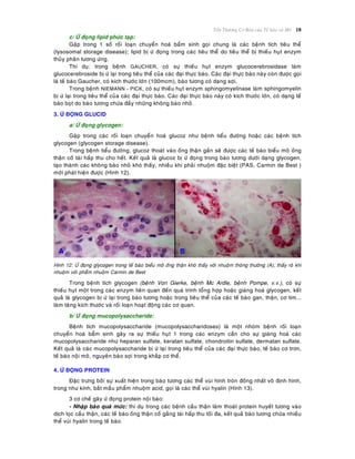 Toån Thöông Cô Baûn cuûa Teá baøo vaø Moâ 18
c/ ÖÙ ñoïng lipid phöùc taïp:
Gaëp trong 1 soá roái loaïn chuyeån hoaù baåm sinh goïi chung laø caùc beänh tích tieâu theå
(lysosomal storage disease); lipid bò öù ñoïng trong caùc tieâu theå do tieâu theå bò thieáu huït enzym
thuûy phaân töông öùng.
Thí duï: trong beänh GAUCHER, coù söï thieáu huït enzym glucocerebrosidase laøm
glucocerebroside bò öù laïi trong tieâu theå cuûa caùc ñaïi thöïc baøo. Caùc ñaïi thöïc baøo naøy coøn ñöôïc goïi
laø teá baøo Gaucher, coù kích thöôùc lôùn (100mcm), baøo töông coù daïng sôïi.
Trong beänh NIEMANN - PICK, coù söï thieáu huït enzym sphingomyelinase laøm sphingomyelin
bò öù laïi trong tieâu theå cuûa caùc ñaïi thöïc baøo. Caùc ñaïi thöïc baøo naøy coù kích thöôùc lôùn, coù daïng teá
baøo boït do baøo töông chöùa ñaày nhöõng khoâng baøo nhoû.
3. ÖÙ ÑOÏNG GLUCID
a/ ÖÙ ñoïng glycogen:
Gaëp trong caùc roái loaïn chuyeån hoaù glucoz nhö beänh tieåu ñöôøng hoaëc caùc beänh tích
glycogen (glycogen storage disease).
Trong beänh tieåu ñöôøng, glucoz thoaùt vaøo oáng thaän gaàn seõ ñöôïc caùc teá baøo bieåu moâ oáng
thaän coá taùi haáp thu cho heát. Keát quaû laø glucoz bò öù ñoïng trong baøo töông döôùi daïng glycogen,
taïo thaønh caùc khoâng baøo nhoû khoù thaáy, nhieàu khi phaûi nhuoäm ñaëc bieät (PAS, Carmin de Best )
môùi phaùt hieän ñöôïc (Hình 12).
Hình 12: ÖÙ ñoïng glycogen trong teá baøo bieåu moâ oáng thaän khoù thaáy vôùi nhuoäm thoâng thöôøng (A); thaáy roõ khi
nhuoäm vôùi phaåm nhuoäm Carmin de Best
Trong beänh tích glycogen (beänh Von Gierke, beänh Mc Ardle, beänh Pompe, v.v.), coù söï
thieáu huït moät trong caùc enzym lieân quan ñeán quaù trình toång hôïp hoaëc giaùng hoaù glycogen, keát
quaû laø glycogen bò öù laïi trong baøo töông hoaëc trong tieâu theå cuûa caùc teá baøo gan, thaän, cô tim...
laøm taêng kích thöôùc vaø roái loaïn hoaït ñoäng caùc cô quan.
b/ ÖÙ ñoïng mucopolysaccharide:
Beänh tích mucopolysaccharide (mucopolysaccharidoses) laø moät nhoùm beänh roái loaïn
chuyeån hoaù baåm sinh gaây ra söï thieáu huït 1 trong caùc enzym caàn cho söï giaùng hoaù caùc
mucopolysaccharide nhö heparan sulfate, keratan sulfate, chondroitin sulfate, dermatan sulfate.
Keát quaû laø caùc mucopolysaccharide bò öù laïi trong tieâu theå cuûa caùc ñaïi thöïc baøo, teá baøo cô trôn,
teá baøo noäi moâ, nguyeân baøo sôïi trong khaép cô theå.
4. ÖÙ ÑOÏNG PROTEIN
Ñaëc tröng bôûi söï xuaát hieän trong baøo töông caùc theå vuøi hình troøn ñoàng nhaát voâ ñònh hình,
trong nhö kính, baét maàu phaåm nhuoäm acid, goïi laø caùc theå vuøi hyalin (Hình 13).
3 cô cheá gaây öù ñoïng protein noäi baøo:
- Nhaäp baøo quaù möùc: thí duï trong caùc beänh caàu thaän laøm thoaùt protein huyeát töông vaøo
dòch loïc caàu thaän, caùc teá baøo oáng thaän coá gaéng taùi haáp thu toái ña, keát quaû baøo töông chöùa nhieàu
theå vuøi hyalin trong teá baøo.
 