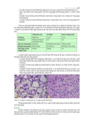 Beänh Lyù Tuyeán Giaùp 264
- U tuyeán nang nhoû (microfollicular adenoma): coøn goïi u tuyeán thai (fetal adenoma), teá
baøo u taïo thaønh caùc nang tuyeán nhoû hôn nang giaùp bình thöôøng quanh u, chöùa ít chaát
keo.
- U tuyeán nang thöôøng (normofollicular adenoma): nang tuyeán cuûa u baèng vôùi nang giaùp
bình thöôøng.
- U tuyeán nang lôùn (macrofollicular adenoma): nang tuyeán cuûa u lôùn hôn nang giaùp bình
thöôøng.
Thöïc ra, vieäc phaân bieät treân khoâng quan troïng vì khoâng coù yù nghóa veà maët laâm saøng. Traùi
laïi, phaûi phaân bieät ñöôïc giöõa u tuyeán vôùi 1 cuïc taêng saûn noåi troäi trong beänh taêng saûn cuïc, giöõa
u tuyeán vaø carcinoâm tuyeán giaùp daïng nang, döïa vaøo caùc ñaëc ñieåm ñöôïc toùm taét trong baûng
sau:
Taêng saûn cuïc U tuyeán Carci. daïng nang
Soá löôïng Nhieàu cuïc 1 cuïc 1 cuïc
Voû bao sôïi Khoâng coù hoaëc coù
khoâng hoaøn toaøn
Coù Coù
Caáu truùc nang tuyeán Ña daïng Ñoàng ñeàu, ñôn daïng Gioáng u tuyeán
Moâ giaùp xung quanh Bình thöôøng Bò cheøn eùp Bò teá baøo u xaâm nhaäp
Xaâm nhaäp voû bao
vaø Maïch maùu
Khoâng Khoâng Coù
U tuyeán tuyeán giaùp daïng nang coù moät soá bieán theå trong ñoù teá baøo u raát khaùc thöôøng, coù
theå gaây nhaàm laãn vôùi moät ung thö:
- U tuyeán khoâng ñieån hình (atypical adenoma): u coù maät ñoä teá baøo cao; teá baøo u keát
thaønh ñaùm ñaëc hoaëc nang tuyeán ñaëc; coù choã, teá baøo u taêng sinh thaønh caùc ñaùm teá baøo
hình thoi.
- U tuyeán coù nhaân quaùi (adenoma with bizarre nuclei): teá baøo u coù nhaân raát lôùn, taêng saéc,
dò daïng.
- U tuyeán teá baøo Hürthle (Hürthle cell adenoma): u coù maät ñoä teá baøo cao; teá baøo u coù
nhaân lôùn, haïch nhaân roõ, baøo töông aùi toan daïng haït. Caùøc teá baøo u keát thaønh ñaùm ñaëc
hoaëc nang tuyeán ñaëc, raát ít chaát keo. (Hình 15)
Hình 15: U tuyeán coù nhaân quaùi (A); U tuyeán teá baøo Hürthle (B)
Phöông phaùp ñieàu trò tieâu chuaån ñoái vôùi u tuyeán tuyeán giaùp daïng nang laø phaãu thuaät caét
troïn thuøy giaùp.
B. U aùc
Chieám khoaûng 1,5% toång soá caùc loaïi ung thö; xaûy ra ôû giôùi nöõ nhieàu hôn giôùi nam. Soá
lieäu ghi nhaän ung thö (2004-08) taïi TP. Hoà Chí Minh vaø Haø noäi vaø cho thaáy ung thö tuyeán giaùp
ñöùng haøng thöù 5 vaø 6 trong 10 loaïi ung thö thöôøng gaëp ôû giôùi nöõ.
 