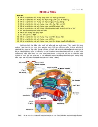 Beänh lyù Thaän 287
BEÄNH LYÙ THAÄN
Muïc tieâu :
1. Moâ taû vaø phaân tích toån thöông trong beänh caàu thaän nguyeân phaùt.
2. Moâ taû vaø phaân tích toån thöông caàu thaän trong beänh lupus ñoû heä thoáng.
3. Moâ taû vaø phaân tích toån thöông caàu thaän trong beänh tieåu ñöôøng.
4. Moâ taû vaø phaân tích caùc toån thöông trong vieâm oáng thaän - moâ keõ.
5. Moâ taû vaø phaân tích caùc toån thöông trong hoaïi töû oáng thaän caáp.
6. Moâ taû vaø phaân tích caùc toån thöông thaän trong cao huyeát aùp laønh tính vaø aùc tính
7. Keå teân toån thöông thaän trong soûi thaän
8. Moâ taû toån thöông thaûi gheùp thaän
9. Keå teân caùc loaïi u thaän.
10. Moâ taû vaø phaân tích caùc toån thöông trong carcinoâm teá baøo thaän.
11. Moâ taû vaø phaân tích caùc toån thöông trong u Wilms.
12. Moâ taû vaø phaân tích caùc toån thöông trong carcinoâm teá baøo chuyeån tieáp beå thaän.
Hai thaän hình haït ñaäu, naèm caïnh coät soáng vaø sau phuùc maïc. Thaän ngöôøi lôùn naëng
khoaûng 150g, daøi 11 cm, roäng 6 cm vaø daøy 3 cm. Caáu taïo moãi thaän goàm 2 vuøng: voû thaän ôû
ngoaøi vaø beân trong laø tuûy thaän. Ñôn vò caáu taïo veà hình thaùi vaø chöùc naêng cuûa thaän ñöôïc goïi laø
ñôn vò thaän (nephron), goàm coù caàu thaän vaø caùc oáng thaän, ñöôïc bao quanh bôûi moâ keõ thaän chöùa
nhieàu maïch maùu; ñaûm nhaän caùc chöùc naêng quan troïng: loïc maùu, taùi haáp thu coù choïn loïc nöôùc
vaø moät soá chaát hoaø tan giuùp duy trì caân baèng noäi moâi (caân baèng nöôùc-dieän giaûi, thaêng baèng
kieàm toan), baøi tieát chaát caën baõ vaø caùc chaát ñoäc. (Hình 1 vaø 2)
Hình 1 : Sô ñoà caáu truùc 3 chieàu caàu thaän bình thöôøng vaø caùc thaønh phaàn lieân quan maøng loïc caàu thaän
 