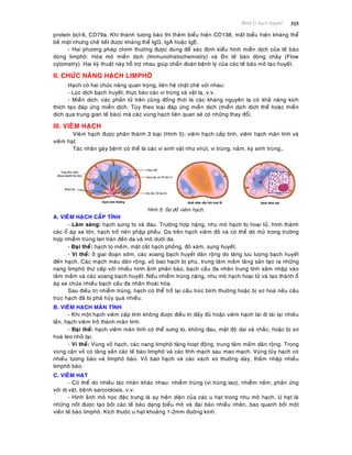 Beänh lyù haïch limphoâ 315
protein bcl-6, CD79a. Khi thaønh töông baøo thì theâm bieåu hieän CD138, maát bieåu hieän khaùng theå
beà maët nhöng cheá tieát ñöôïc khaùng theå IgG, IgA hoaëc IgE.
- Hai phöông phaùp chính thöôøng ñöôïc duøng ñeå xaùc ñònh kieåu hình mieãn dòch cuûa teá baøo
doøng limphoâ: Hoùa moâ mieãn dòch (Immunohistochemistry) vaø Ño teá baøo doøng chaûy (Flow
cytometry). Hai kyõ thuaät naøy hoã trôï nhau giuùp chaån ñoaùn beänh lyù cuûa caùc teá baøo moâ taïo huyeát.
II. CHÖÙC NAÊNG HAÏCH LIMPHOÂ
Haïch coù hai chöùc naêng quan troïng, lieân heä chaët cheõ vôùi nhau:
- Loïc dòch baïch huyeát, thöïc baøo caùc vi truøng vaø vaät laï, v.v.
- Mieãn dòch: caùc phaàn töû treân cuõng ñoàng thôøi laø caùc khaùng nguyeân laï coù khaû naêng kích
thích taïo ñaùp öùng mieãn dòch. Tuøy theo loaïi ñaùp öùng mieãn dòch (mieãn dòch dòch theå hoaëc mieãn
dòch qua trung gian teá baøo) maø caùc vuøng haïch lieân quan seõ coù nhöõng thay ñoåi.
III. VIEÂM HAÏCH
Vieâm haïch ñöôïc phaân thaønh 3 loaïi (Hình 5): vieâm haïch caáp tính, vieâm haïch maõn tính vaø
vieâm haït.
Taùc nhaân gaây beänh coù theå laø caùc vi sinh vaät nhö viruùt, vi truøng, naám, kyù sinh truøng…
Hình 5: Sô ñoà vieâm haïch.
A. VIEÂM HAÏCH CAÁP TÍNH
- Laâm saøng: haïch söng to vaø ñau. Tröôøng hôïp naëng, nhu moâ haïch bò hoaïi töû, hình thaønh
caùc oå aùp xe lôùn, haïch trôû neân phaäp pheàu. Da treân haïch vieâm ñoû vaø coù theå doø muû trong tröôøng
hôïp nhieãm truøng lan traøn ñeán da vaø moâ döôùi da.
- Ñaïi theå: haïch to meàm, maët caét haïch phoàng, ñoû xaùm, sung huyeát.
- Vi theå: ôû giai ñoaïn sôùm, caùc xoang baïch huyeát daõn roäng do taêng löu löôïng baïch huyeát
ñeán haïch. Caùc maïch maùu daõn roäng, voû bao haïch bò phuø, trung taâm maàm taêng saûn taïo ra nhöõng
nang limphoâ thöù caáp vôùi nhieàu hình aûnh phaân baøo, baïch caàu ña nhaân trung tính xaâm nhaäp vaøo
taâm maàm vaø caùc xoang baïch huyeát. Neáu nhieãm truøng naëng, nhu moâ haïch hoaïi töû vaø taïo thaønh oå
aùp xe chöùa nhieàu baïch caàu ña nhaân thoaùi hoùa.
Sau ñieàu trò nhieãm truøng, haïch coù theå trôû laïi caáu truùc bình thöôøng hoaëc bò xô hoaù neáu caáu
truùc haïch ñaõ bò phaù huûy quaù nhieàu.
B. VIEÂM HAÏCH MAÕN TÍNH
- Khi moät haïch vieâm caáp tính khoâng ñöôïc ñieàu trò ñaày ñuû hoaëc vieâm haïch taùi ñi taùi laïi nhieàu
laàn, haïch vieâm trôû thaønh maõn tính.
- Ñaïi theå: haïch vieâm maõn tính coù theå söng to, khoâng ñau, maät ñoä dai vaø chaéc; hoaëc bò xô
hoaù teo nhoû laïi.
- Vi theå: Vuøng voû haïch, caùc nang limphoâ taêng hoaït ñoäng, trung taâm maàm daõn roäng. Trong
vuøng caän voû coù taêng saûn caùc teá baøo limphoâ vaø caùc tónh maïch sau mao maïch. Vuøng tuûy haïch coù
nhieàu töông baøo vaø limphoâ baøo. Voû bao haïch vaø caùc vaùch xô thöôøng daøy, thaám nhaäp nhieàu
limphoâ baøo.
C. VIEÂM HAÏT
- Coù theå do nhieàu taùc nhaân khaùc nhau: nhieãm truøng (vi truøng lao), nhieãm naám, phaûn öùng
vôùi dò vaät, beänh sarcoidosis, v.v.
- Hình aûnh moâ hoïc ñaëc tröng laø söï hieän dieän cuûa caùc u haït trong nhu moâ haïch. U haït laø
nhöõng noát ñöôïc taïo bôûi caùc teá baøo daïng bieåu moâ vaø ñaïi baøo nhieàu nhaân, bao quanh bôûi moät
vieàn teá baøo limphoâ. Kích thöôùc u haït khoaûng 1-2mm ñöôøng kính.
 