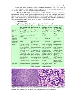 Beänh lyù haïch limphoâ 321
Kieåu hình mieãn dòch vaø nguoàn goác teá baøo u: teá baøo Reed - Sternberg coù CD15+, CD30+. CD45-, J
chain -, CD20+/-, CD79a+/-. 98% tröôøng hôïp limphoâm Hodgkin kinh ñieån, teá baøo u coù nguoàn goác töø teá baøo B
cuûa taâm maàm, moät soá ít coøn laïi coù nguoàn goác töø limphoâ baøo T ngoaïi vi.
b.3. Caùc thaønh phaàn teá baøo phaûn öùng chieám hôn 90% theå tích u, goàm limphoâ baøo, töông
baøo, baïch caàu ña nhaân aùi toan, baïch caàu ña nhaân trung tính vaø moâ baøo. Tæ leä thaønh phaàn limphoâ
baøo bình thöôøng so vôùi thaønh phaàn teá baøo taân sinh cho bieát möùc ñoä ñaùp öùng mieãn dòch cuûa beänh
nhaân. Do ñoù, tyùp moâ hoïc coù soá löôïng limphoâ baøo thaáp chöùng toû beänh nhaân ñaùp öùng mieãn dòch
keùm, tieân löôïng beänh seõ xaáu hôn so vôùi tyùp moâ hoïc coù tæ leä teá baøo limphoâ cao.
b.4. Caùc tyùp moâ hoïc:
Baûng 2: Caùc tyùp moâ hoïc cuûa limphoâm Hodgkin kinh ñieån. (Hình 14,15)
Limphoâm Hodgkin
kinh ñieån loaïi giaøu
limphoâ baøo
Limphoâm Hodgkin
kinh ñieån loaïi xô
cuïc
Limphoâm Hodgkin
kinh ñieån loaïi hoãn
hôïp teá baøo
Limphoâm Hodgkin
kinh ñieån loaïi
ngheøo limphoâ baøo
Tæ leä % 5% 70% 20-25% < 5%
Giôùi Thöôøng gaëp ôû giôùi
nam
Nam/Nöõ = 1/1 Thöôøng gaëp ôû giôùi
nam
Thöôøng gaëp ôû giôùi
nam
Tuoåi trung
bình
Hôi cao hôn caùc tyùp
coøn laïi
28 tuoåi 37 tuoåi 37 tuoåi
Giai ñoaïn
laâm saøng
I hoaëc II II III hoaëc IV IV
Trieäu chöùng
toaøn thaân
Ít gaëp 40% caùc tröôøng
hôïp
Thöôøng gaëp 80% caùc tröôøng
hôïp
Vi theå - Teá baøo R-S kinh
ñieån raát ít, moät soá
coù theå troâng gioáng
teá baøo LP nhöng coù
haïch nhaân lôùn hôn
vaø aùi toan.
- Nhieàu limphoâ baøo
tröôûng thaønh vaø moâ
baøo, baïch caàu ña
nhaân khoâng coù
hoaëc raát ít.
- Khoâng coù xô hoùa.
- Caùc daûi sôïi
collagen phaân caét
nhu moâ haïch thaønh
caùc cuïc.
- Trong cuïc coù teá
baøo R-S daïng hoác,
teá baøo R-S kinh
ñieån ít gaëp, nhieàu
limphoâ baøo, baïch
caàu ña nhaân aùi toan
vaø baïch caàu ña
nhaân trung tính.
- Hình aûnh hoãn hôïp
teá baøo vôùi nhieàu teá
baøo R-S kinh ñieån,
nhieàu teá baøo
Hodgkin, nhieàu
baïch caàu ña nhaân
trung tính, baïch caàu
ña nhaân aùi toan, moâ
baøo, töông baøo,
limphoâ baøo.
- Haàu nhö khoâng coù
xô hoùa
Hình aûnh ngheøo
limphoâ baøo vaø
nhieàu teá baøo R-S.
Coù hai daïng:
- Daïng xô hoùa lan
toûa: moâ haïch
ngheøo teá baøo vaø bò
xô hoùa.
- Daïng löôùi: coù
nhieåu teá baøo RS
thoaùi saûn dò daïng,
ñaïi thöïc baøo vaø
baïch caàu ña nhaân.
Tieân löôïng Toát hôn caùc tyùp coøn
laïi
Toát hôn tyùp hoãn
hôïp teá baøo vaø
ngheøo limphoâ baøo
Xaáu hôn tyùp xô cuïc
vaø toát hôn tyùp
ngheøo limphoâ baøo
Xaáu
Hình 14: Limphoâm Hodgkin kinh ñieån loaïi giaøu limphoâ baøo: Caáu truùc haïch bò xoùa (A); Teá baøo RS daïng nhieàu
thuøy nhaân gioáng teá baøo LP, naèm treân neàn raát nhieàu limphoâ baøo tröôûng thaønh vaø moâ baøo (B).
 
