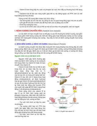Beänh Lyù Xöông Khôùp Phaàn meàm 335
- Vitamin D laøm taêng haáp thu calci vaø phospho taïi ruoät, thuùc ñaåy söï khoaùng hoaù chaát daïng
xöông.
- Calcitonin do teá baøo caän nang tuyeán giaùp tieát ra, taùc ñoäng ngöôïc vôùi PTH, laøm öùc cheá
hoaït ñoäng cuûa huûy coát baøo.
Trong cô theå, boä xöông ñaûm nhieäm caùc chöùc naêng :
- Taïo khung baûo veä cho naõo boä, tuûy soáng vaø caùc cô quan trong loàng ngöïc nhö tim vaø phoåi.
- Laøm giaù ñôõ cho caùc cô baùm vaøo ñeå thöïc hieän caùc cöû ñoäng cuûa cô theå.
- Chöùa tuûy xöông taïo maùu.
- Laø nôi döï tröõ chính calci cuûa cô theå vaø moät soá ion khaùc nhö phosphaùt, natri vaø magneâ.
I. BEÄNH XÖÔNG CHUYEÅN HOÙA (metabolic bone diseases)
Laø caùc beänh roái loaïn chuyeån hoaù coù theå gaây ra caùc toån thöông thöù phaùt ôû xöông, bao goàm
tình traïng giaûm khoái löôïng xöông (do maát caân baèng giöõa hoaït ñoäng taïo xöông vaø huûy xöông)
vaø/hoaëc tình traïng giaûm khoaùng hoaù xöông. Sau ñaây laø moät soá beänh xöông chuyeån hoaù töông
ñoái thöôøng gaëp:
A. BEÄNH MEÀM XÖÔNG vaø BEÄNH COØI XÖÔNG (Osteomalacia & Rickets):
Laø beänh xöông chuyeån hoùa ñöôïc ñaëc tröng bôûi tình traïng khoaùng hoùa khoâng ñaày ñuû chaát
daïng xöông. Beänh xaûy ra ôû ngöôøi lôùn ñöôïc goïi laø beänh meàm xöông, xöông khoâng ñöôïc khoaùng
hoùa ñaày ñuû neân deã gaõy. Beänh xaûy ra ôû treû em ñöôïc goïi laø beänh coøi xöông, vì xöông coøn ñang
taêng tröôûng, suïn tieáp hôïp chöa ñoùng neân boä xöông deã bò bieán daïng.
Nguyeân nhaân vaø cô cheá beänh sinh:
Nguyeân nhaân gaây beänh thöôøng gaëp
nhaát cuûa beänh meàm xöông vaø coøi xöông laø
tình traïng thieáu huït vitamin D hoaëc roái loaïn
chuyeån hoùa vitamin D.
Vitamin D caàn thieát cho cô theå coù saün
trong thöùc aên vaø ñöôïc haáp thu taïi ruoät;
hoaëc ñöôïc toång hôïp môùi töø 7-
dehydrocholesterol taïi da, döôùi taùc ñoäng
cuûa tia cöïc tím coù trong aùnh saùng maët trôøi.
Vitamin D naøy vaãn coøn ôû daïng chöa hoaït
ñoäng (cholecalciferol), seõ ñöôïc hydroxyl
hoùa taïi gan thaønh 25-hydroxycholecalciferol
vaø sau ñoù laïi ñöôïc hydroxyl hoùa laân thöù hai
taïi thaän döôùi taùc ñoäng cuûa hormoân PTH
cuûa tuyeán caän giaùp ñeå trôû thaønh daïng hoaït
ñoäng (1,25-dihydroxy-cholecalciferol).
Chöùc naêng chính cuûa vitamin D laø
duy trì söï oån ñònh haøm löôïng calci vaø
phospho trong maùu, ñieàu kieän caàn thieát cho
hoaït ñoäng khoaùng hoùa taïi xöông, thoâng qua
caùc taùc ñoäng taïi ruoät, xöông vaø thaän.
- Taïi ruoät: kích thích söï haáp thu calci
vaø phospho.
- Taïi xöông: phoái hôïp vôùi PTH cuûa
tuyeán caän giaùp, ñieàu hoøa hoaït ñoäng cuûa
huûy coát baøo vaø kích thích taïo coát baøo hoaït
ñoäng gaây khoaùng hoùa chaát daïng xöông.
- Taïi thaän: kích thích söï taùi haáp thu
calci taïi oáng thaän xa.
Hình 3: Chuyeån hoaù vitamin D
 