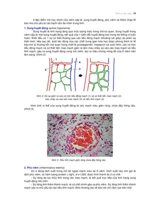 Vieâm vaø söûa chöõa 34
3 ñaëc ñieåm moâ hoïc chính cuûa vieâm caáp laø: sung huyeát ñoäng, phuø vieâm vaø thaám nhaäp teá
baøo maø chuû yeáu laø caùc baïch caàu ña nhaân trung tính.
1. Sung huyeát ñoäng (active hyperemia)
Sung huyeát laø tình traïng taêng quaù möùc löôïng maùu trong moâ-cô quan. Sung huyeát trong
vieâm caáp laø moät sung huyeát ñoäng, keát quaû cuûa 1 bieán ñoåi huyeát ñoäng hoïc trong heä thoáng vi tuaàn
hoaøn. Khôûi ñaàu coù 1 söï co thaét thoaùng qua caùc tieåu ñoäng maïch (khoaûng vaøi giaây) do phaûn xaï
thaàn kinh; tieáp sau ñoù, döôùi taùc ñoäng cuûa caùc chaát trung gian hoùa hoïc ñöôïc phoùng thích töø teá
baøo-moâ bò thöông toån maø quan troïng nhaát laø prostaglandin, hiastamin vaø oxid nitric, caùc cô trôn
tieåu ñoäng maïch vaø cô thaét tieàn mao maïch giaõn ra laøm maùu chaûy uøa vaøo caùc mao maïch vaø tieåu
tónh maïch, gaây ra sung huyeát ñoäng vuøng moâ vieâm, taïo ra trieäu chöùng noùng ñoû cuûa oå vieâm treân
laâm saøng. (Hình 2)
Hình 2: Do söï giaõn ra cuûa cô trôn tieåu ñoäng maïch (1) vaø cô thaét tieàn mao maïch (2),
maùu chaûy uøa vaøo löôùi mao maïch (3) vaø tieåu tónh maïch (4)
Hình aûnh vi theå cuûa sung huyeát ñoäng laø caùc maïch maùu giaõn roäng, chöùa ñaày hoàng caàu.
(Hình 3)
Hình 3: Tieåu tónh maïch giaõn roäng chöùa ñaày hoàng caàu
2. Phuø vieâm (inflammatory edema)
Do öù ñoïng dòch xuaát trong moâ keõ ngoaøi maïch maùu taïi oå vieâm. Dòch xuaát naøy coøn goïi laø
dòch phuø vieâm, coù haøm löôïng protein  3g%, d >1,020; ñöôïc hình thaønh do 2 cô cheá:
- Söï taêng aùp löïc thuûy tónh trong caùc mao maïch, laø keát quaû tröïc tieáp cuûa tình traïng sung
huyeát ñoäng neâu treân.
- Söï taêng tính thaám thaønh maïch, laø cô cheá chính gaây ra phuø vieâm. Söï taêng tính thaám thaønh
maïch xaûy ra chuû yeáu taïi caùc tieåu tónh maïch. Bình thöôøng caùc teá baøo noäi moâ naèm töïa treân moät
 