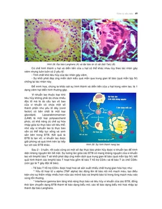 Vieâm vaø söûa chöõa 49
Hình 28: Ñaïi baøo Langhans (A) vaø ñaïi baøo aên dò vaät (boät Talc) (B)
Cô cheá hình thaønh u haït vaø dieãn tieán cuûa u haït coù theå khaùc nhau tuøy theo taùc nhaân gaây
vieâm nhöng luoân luoân coù 2 yeáu toá:
- Tính chaát khoù tieâu huûy cuûa taùc nhaân gaây vieâm.
- Söï khôûi phaùt ñaùp öùng mieãn dòch kieåu quaù maãn qua trung gian teá baøo (quaù maãn tyùp IV)
choáng laïi taùc nhaân naøy.
Ñeå minh hoïa, chuùng ta khaûo saùt söï hình thaønh vaø dieãn tieán cuûa u haït trong vieâm lao, laø 1
daïng vieâm haït ñieån hình thöôøng gaëp.
Vi khuaån lao thuoäc loaïi khoù
tieâu huûy khoâng phaûi do chöùa nhieàu
ñoäc toá maø laø do caáu taïo voû bao
cuûa vi khuaån coù chöùa moät soá
thaønh phaàn nhö yeáu toá daây (cord
factor) coù baûn chaát laø moät loaïi
glycolipid, Lipoarabinomannan
(LAM) laø moät loaïi polysaccharid
phöùc, coù khaû naêng öùc cheá söï hoøa
nhaäp giöõa tuùi thöïc baøo vôùi tieâu theå;
nhôø vaäy vi khuaån lao bò thöïc baøo
vaãn coù theå tieáp tuïc soáng vaø sinh
saûn beân trong ÑTB. Keát quaû laø
ÑTB bò tan vôõ; vi khuaån lao ñöôïc
giaûi phoùng vaø quaù trình treân laïi tieáp
tuïc vôùi caùc ÑTB khaùc. Hinh 29: Söï hình thaønh nang lao
Sau 2 - 3 tuaàn, roát cuoäc cuõng coù moät soá ñaïi thöïc baøo phaân huûy ñöôïc vi khuaån lao ñeå trình
dieän khaùng nguyeân leân beà maët. Söï töông taùc giöõa caùc ÑTB coù mang khaùng nguyeân cuûa vi khuaån
lao vôùi limphoâ baøo T seõ khôûi phaùt ñaùp öùng mieãn dòch qua trung gian teá baøo (quaù maãn tyùp IV); keát
quaû hình thaønh caùc limphoâ baøo T hoaït hoùa goàm teá baøo T hoã trôï CD4+ vaø teá baøo T öùc cheá CD8+
(coøn goïi laø T gaây ñoäc teá baøo).
- Teá baøo T hoã trôï CD4+ ñöôïc hoaït hoaù seõ saûn xuaát nhieàu chaát trung gian hoùa hoïc nhö:
* Yeáu toá hoaïi töû u alpha (TNF alpha) taùc ñoäng leân teá baøo noäi moâ maïch maùu, taïo ñieàu
kieän cho söï thaám nhaäp nhieàu hôn nöõa caùc moânoâ baøo vaø limphoâ baøo töø trong loøng maïch maùu vaøo
vuøng toån thöông,
* Interferon gamma laøm taêng khaû naêng thöïc baøo vaø tieâu huûy vi khuaån cuûa caùc ÑTB, ñoàng
thôøi laøm chuyeån daïng ÑTB thaønh teá baøo daïng bieåu moâ; caùc teá baøo daïng bieåu moâ hoaø nhaäp laïi
thaønh ñaïi baøo Langhans.
 