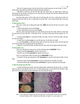 Beänh lyù U 58
- Moâ chuû U (parenchyma): taïo bôûi caùc teá baøo chuyeån daïng töùc laø caùc teá baøo u; chính
thaønh phaàn naøy quyeát ñònh dieãn tieán cuõng nhö teân goïi cuûa khoái u.
- Moâ ñeäm U (stroma): taïo bôûi moâ lieân keát, caùc maïch maùu vaø maïch baïch huyeát; tuy
khoâng phaûi laø caùc teá baøo u nhöng coù vai troø naâng ñôõ vaø cung caáp caùc chaát dinh döôõng caàn thieát
cho söï taêng tröôûng cuûa khoái u.
Söï phaân bieät giöõa 2 thaønh phaàn treân thì deã daøng ñoái vôùi caùc u xuaát phaùt töø bieåu moâ
nhöng raát khoù khaên ñoái vôùi caùc u xuaát phaùt töø moâ lieân keát, vì caû 2 thaønh phaàn ñeàu coù chung
nguoàn goác
A. Danh phaùp u laønh:
Teân cuûa u ñöôïc taïo ra baèng caùch gaén ñuoâi OMA vaøo teân loaïi teá baøo maø töø ñoù u xuaát
phaùt. Thí duï:
* U laønh xuaát phaùt töø moâ sôïi laø fibroma
* U laønh xuaát phaùt töø moâ suïn laø chondroma
Ñoái vôùi u laønh xuaát phaùt töø bieåu moâ, vieäc ñaët teân phöùc taïp hôn nhieàu. Moät soá u ñöôïc ñaët
teân döïa theo hình aûnh ñaïi theå, vi theå hoaëc caû hai; soá khaùc laïi döïa theo teá baøo nguyeân uûy. Thí
duï:
* U tuyeán (adenoma) laø u xuaát phaùt töø bieåu moâ tuyeán, hình aûnh vi theå cho thaáy u taïo bôûi
caùc caáu truùc tuyeán.
* U tuyeán boïc (cystadenoma) laø u taïo bôûi caùc boïc, loùt bôûi bieåu moâ tuyeán
* U nhuù (Papilloma) u xuaát phaùt töø caùc bieåu moâ phuû (da, oáng tieâu hoaù), hình aûnh ñaïi theå
vaø vi theå cho thaáy caáu truùc gioáng nhö laù caây döông xæ.
* Polyùp laø u xuaát phaùt töø bieåu moâ phuû cuûa caùc nieâm maïc (thí duï polyùp tuyeán ñaïi traøng)
B. Danh phaùp u aùc:
Caùc u aùc xuaát phaùt töø trung moâ vaø moâ lieân keát ñöôïc goïi laø SARCOÂM. Thí duï:
* Sarcoâm sôïi (fibrosarcoma) laø ung thö cuûa moâ sôïi.
* Sarcoâm suïn (chondrosarcoma) laø ung thö cuûa moâ suïn.
Caùc u aùc xuaát phaùt töø bieåu moâ ñöôïc goïi laø CARCINOÂM. Thí duï:
* Carcinoâm teá baøo gai (squamous cell carcinoma) laø ung thö xuaát phaùt töø bieåu moâ laùt
taàng.
* Carcinoâm tuyeán (adenocarcinoma) laø ung thö xuaát phaùt töø caùc bieåu moâ tuyeán.
* Carcinoâm teá baøo gan (hepatocellular carcinoma) laø ung thö xuaát phaùt töø teá baøo gan.
C. Moät soá tröôøng hôïp ñaëc bieät:
- U tuyeán ña daïng cuûa tuyeán nöôùc boït (pleomorphic adenoma): ñaïi ña soá caùc u, duø laønh
hoaëc aùc, ñeàu coù caùc teá baøo cuûa moâ chuû u ít nhieàu gioáng nhau; lyù do laø taát caû caùc teá baøo u ñeàu
ñöôïc sinh ra töø moät teá baøo chuyeån daïng ñaàu tieân (tính chaát ñôn doøng).
Hình 4: U hoãn hôïp tuyeán mang tai (A); ñaïi theå u giôùi haïn roõ, maët caét ñaëc, oùng aùnh do coù vuøng bieät
hoùa theo höôùng suïn (B); vi theå goàm caùc ñaùm bieåu moâ tuyeán (1) vaø suïn trong (2, C).
 