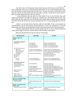 Beänh lyù U 59
Tuy nhieân trong 1 soá tröôøng hôïp, teá baøo chuyeån daïng coù theå sinh saûn vaø bieät hoaù theo
nhieàu höôùng khaùc nhau, taïo ra u hoãn hôïp nhieàu thaønh phaàn. Thí duï u tuyeán ña daïng tuyeán nöôùc
boït, caáu taïo goàm caùc ñaùm teá baøo bieåu moâ naèm treân 1 moâ ñeäm sôïi nieâm coù chöùa caùc oå xöông
hoaëc suïn, taát caû caùc thaønh phaàn khaùc nhau naøy ñeàu coù chung 1 nguoàn goác laø caùc teá baøo cô -
bieåu moâ chuyeån daïng cuûa tuyeán nuôùc boït. (Hình 4)
- U quaùi (teratoma): caáu taïo goàm caùc thaønh phaàn teá baøo vaø moâ raát khaùc nhau xuaát
nguoàn töø caû 3 laù phoâi - nhö bieåu moâ, xöông, suïn, moâ thaàn kinh - saép xeáp hoãn ñoän vôùi nhau. Caùc
thaønh phaàn treân ñeàu ñöôïc sinh ra töø moät teá baøo maàm chuyeån daïng, laø teá baøo coù khaû naêng bieät
hoaù thaønh baát kyø loaïi teá baøo naøo trong cô theå (xem hình 40, 41 trong chöông beänh lyù sinh duïc
nöõ).
- Moät soá u aùc laïi ñöôïc ñaët teân theo kieåu u laønh vôùi ñuoâi OMA. Thi duï u aùc trung bieåu moâ
(mesothelioma), ung thö haïch nguyeân phaùt (lymphoma), u haéc toá aùc (melanoma), u tinh baøo
(seminoma). Caùc teân goïi naøy khoâng hôïp lyù nhöng vì quaù quen duøng neân vaãn ñöôïc giöõ nguyeân.
- Moät soá u ñöôïc ñaët teân theo teân cuûa taùc giaû ñaàu tieân tìm ra. Thí duï sarcoâm Ewing cuûa
xöông, beänh Hodgkin cuûa haïch, limphoâm Burkitt, sarcoâm Kaposi, böôùu Wilms...
Baûng sau ñaây giôùi thieäu teân goïi cuûa moät soá u thöôøng gaëp:
MOÂ NGUYEÂN UÛY LAØNH TÍNH AÙC TÍNH
Chuû moâ u goàm 1 loaïi
teá baøo:
- U xuaát phaùt töø trung moâ:
Moâ lieân keát U sôïi (fibroma)
U môõ (lipoma)
U suïn (chondroma)
U xöông (osteoma)
Sarcoâm sôïi (fibrosarcoma)
Sarcoâm môõ (liposarcoma)
Sarcoâm suïn (chondrosarcoma)
Sarcoâm xöông (osteosarcoma)
Noäi moâ vaø moâ lieân quan:
* Maïch maùu
* Maïch baïch huyeát
* Trung bieåu moâ
* Maøng naõo
U maïch maùu (hemangioma)
U baïch maïch (lymphangioma)
U maøng naõo (meningioma)
Sarcoâm maïch maùu (angiosarcoma)
Sarcoâm baïch maïch (lymphangiosarcoma)
U aùc trung bieåu moâ (mesothelioma)
U maøng naõo xaâm laán
Moâ taïo huyeát Beänh baïch caàu (leukemia)
Moâ limphoâ Limphoâm (lymphoma)
Moâ cô
* Cô vaân
* Cô trôn
U cô trôn (leiomyoma)
U cô vaân (rhabdomyoma)
Sarcoâm cô trôn (leiomyosarcoma)
Sarcoâm cô vaân (rhabdomyosarcoma)
- U xuaát phaùt töø bieåu moâ
Bieåu moâ laùt taàng
Teá baøo lôùp ñaùy cuûa da
U nhuù (papilloma) Carcinoâm teá baøo gai
Carcinoâm teá baøo ñaùy
Bieåu moâ tuyeán U tuyeán (adenoma)
U nhuù (papilloma)
U tuyeán boïc (cystadenoma)
Carcinoâm tuyeán (adenocarcinoma)
Carcinoâm daïng nhuù (papillary carcinoma)
Carcinoâm tuyeán boïc (cystadenocarcinoma)
Ngoaïi bì thaàn kinh Noát ruoài (nevus) melanoâm aùc (malignant melanoma)
Teá baøo gan U tuyeán teá baøo gan (adenoma) Carcinoâm teá baøo gan
(hepatic cell carcinoma)
Bieåu moâ nieäu U nhuù Carcinoâm nieäu maïc
Bieåu moâ nhau thai Nhau nöôùc (hydatidiform mole) Carcinoâm ñeäm nuoâi (choriocarcinoma)
Bieåu moâ sinh tinh U tinh baøo (seminoma)
Chuû moâ > 1 loaïi teá baøo nhöng
thuoäc cuøng 1 laù phoâi:
Tuyeán nöôùc boït U tuyeán ña daïng tuyeán nöôùc
boït
Carcinoâm treân neàn U tuyeán ña daïng
Chuû moâ > 1 loaïi teá baøo, thuoäc
nhieàu laù phoâi:
Buoàng tröùng hoaëc tinh hoaøn U quaùi tröôûng thaønh (mature
teratoma)
U quaùi chöa tröôûng thaønh (immature
teratoma)
U quaùi tröôûng thaønh hoùa aùc
 
