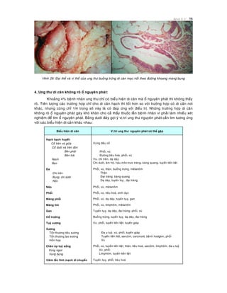 Beänh lyù U 75
Hình 29: Ñaïi theå vaø vi theå cuûa ung thö buoàng tröùng di caên maïc noái theo ñöôøng khoang maøng buïng
4. Ung thö di caên khoâng roõ oå nguyeân phaùt:
Khoaûng 4% beänh nhaân ung thö chæ coù bieåu hieän di caên maø oå nguyeân phaùt thì khoâng thaáy
roõ. Tieân löôïng caùc tröôøng hôïp chæ cho di caên haïch thì toát hôn so vôùi tröôøng hôïp coù di caên nôi
khaùc, nhöng cuõng chæ 1/4 trong soá naøy laø coù ñaùp öùng vôùi ñieàu trò. Nhöõng tröôøng hôïp di caên
khoâng roõ oå nguyeân phaùt gaây khoù khaên cho caû thaày thuoác laãn beänh nhaân vì phaûi laøm nhieàu xeùt
nghieäm ñeå tìm oå nguyeân phaùt. Baûng döôùi ñaây gôïi yù vò trí ung thö nguyeân phaùt caàn tìm töông öùng
vôùi caùc bieåu hieän di caên khaùc nhau:
Bieåu hieän di caên Vò trí ung thö nguyeân phaùt coù theå gaëp
Haïch baïch huyeát:
Coå treân vaø giöõa
Coå döôùi vaø treân ñoøn
Beân phaûi
Beân traùi
Naùch
Beïn
Vuøng ñaàu coå
Phoåi, vuù
Ñöôøng tieâu hoaù, phoåi, vuù
Vuù, chi treân, daï daøy
Chi döôùi, aâm hoä, haäu moân-tröïc traøng, baøng quang, tuyeán tieàn lieät
Da
Chi treân
Buïng, chi döôùi
Roán
Phoåi, vuù, thaän, buoàng tröùng, meâlanoâm
Thaän
Ñaïi traøng, baøng quang
Daï daøy, tuyeán tuî , ñaïi traøng
Naõo Phoåi, vuù, meâlanoâm
Phoåi Phoåi, vuù, tieâu hoaù, sinh duïc
Maøng phoåi Phoåi, vuù, daï daøy, tuyeán tuïy, gan
Maøng tim Phoåi, vuù, limphoâm, meâlanoâm
Gan Tuyeán tuïy, daï daøy, ñaïi traøng, phoåi, vuù
Coå tröôùng Buoàng tröùng, tuyeán tuïy, daï daøy, ñaïi traøng
Tuyû xöông Vuù, phoåi, tuyeán tieàn lieät, tuyeán giaùp
Xöông
Toån thöông tieâu xöông
Toån thöông taïo xöông
Hoãn hôïp
Ña u tuyû, vuù, phoåi, tuyeán giaùp
Tuyeán tieàn lieät, sarcoâm, carcinoid, beänh hodgkin, phoåi
Vuù
Cheøn eùp tuyû soáng
Vuøng ngöïc
Vuøng buïng
Phoåi, vuù, tuyeán tieàn lieät, thaän, tieâu hoaù, sarcoâm, limphoâm, ña u tuyû
Vuù, phoåi
Limphoâm, tuyeán tieàn lieät
Vieâm taéc tónh maïch di chuyeån Tuyeán tuïy, phoåi, tieâu hoaù
 