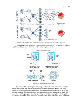 Beänh lyù U 89
Hình 45 : Moâ hình 2 cuù ñaùnh cuûa Knudson trong cô cheá phaùt sinh u nguyeân baøo voõng maïc
2. Gen p53: laø moät gen öùc cheá u khaùc naèm treân nhieãm saéc theå 17. Ngöôøi ta ghi nhaän coù
söï baát hoaït caû 2 gen alen p53 trong haàu heát caùc loaïi ung thö ôû ngöôøi.
Hình 46: Cô cheá taùc ñoäng cuûa gen p53
Khaùc vôùi gen Rb, hoaït ñoäng kìm haõm cuûa gen p53 chæ xaûy ra khi ADN cuûa teá baøo bò toån
thöông (moät caùch töï phaùt hoaëc do taùc ñoäng cuûa caùc yeáu toá moâi tröôøng). Khi ñoù, haøm löôïng
protein p53 trong nhaân taêng leân nhanh choùng, giuùp teá baøo ngöøng laïi ôû giai ñoaïn G1 ñeå coù thôøi
gian söûa chöõa caùc toån thöông treân ADN. Neáu söûa chöõa thaønh coâng, teá baøo tieáp tuïc ñi vaøo giai
ñoaïn S vaø hoaït ñoäng taêng sinh bình thöôøng; tröôøng hôïp thaát baïi, protein p53 seõ laøm taêng saûn
xuaát protein Bax vaø Bak, ñoàng thôøi öùc cheá bcl-2; keát quaû laø teá baøo bò thuùc ñaåy ñi vaøo quaù trình töï
 