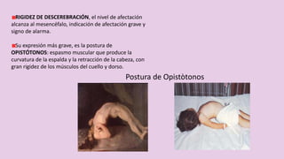 RIGIDEZ DE DESCEREBRACIÓN, el nivel de afectación
alcanza al mesencéfalo, indicación de afectación grave y
signo de alarma.
Su expresión más grave, es la postura de
OPISTÓTONOS: espasmo muscular que produce la
curvatura de la espalda y la retracción de la cabeza, con
gran rigidez de los músculos del cuello y dorso.
Postura de Opistòtonos
 