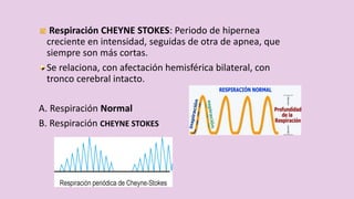 Respiración CHEYNE STOKES: Periodo de hipernea
creciente en intensidad, seguidas de otra de apnea, que
siempre son más cortas.
Se relaciona, con afectación hemisférica bilateral, con
tronco cerebral intacto.
A. Respiración Normal
B. Respiración CHEYNE STOKES
 