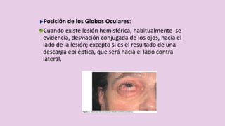 Posición de los Globos Oculares:
Cuando existe lesión hemisférica, habitualmente se
evidencia, desviación conjugada de los ojos, hacia el
lado de la lesión; excepto si es el resultado de una
descarga epiléptica, que será hacia el lado contra
lateral.
 