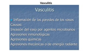 Vasculitis
 