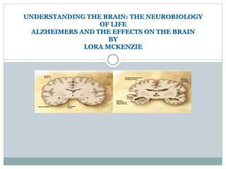 UNDERSTANDING THE BRAIN: THE NEUROBIOLOGY
OF LIFE
ALZHEIMERS AND THE EFFECTS ON THE BRAIN
BY
LORA MCKENZIE
 
