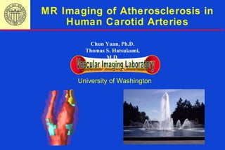 MR Imaging of Atherosclerosis in
Human Carotid Arteries
University of Washington
Chun Yuan, Ph.D.
Thomas S. Hatsukami,
M.D.
 
