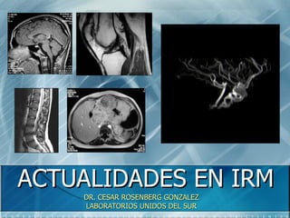 ACTUALIDADES EN IRM DR. CESAR ROSENBERG GONZALEZ LABORATORIOS UNIDOS DEL SUR 
