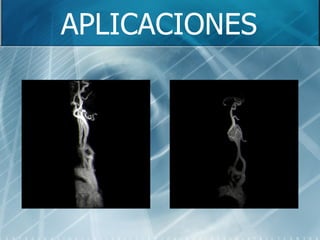 APLICACIONES 