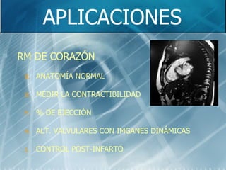 APLICACIONES RM DE CORAZÓN ANATOMÍA NORMAL MEDIR LA CONTRACTIBILIDAD % DE EJECCIÓN ALT. VALVULARES CON IMGANES DINÁMICAS CONTROL POST-INFARTO 