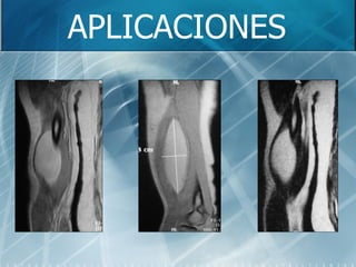 APLICACIONES 