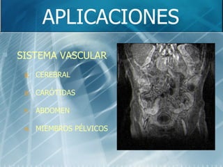 APLICACIONES SISTEMA VASCULAR CEREBRAL CARÓTIDAS ABDOMEN MIEMBROS PÉLVICOS 