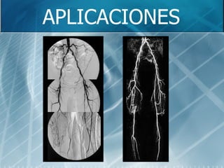 APLICACIONES 