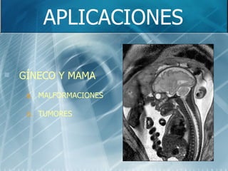 APLICACIONES GÍNECO Y MAMA MALFORMACIONES TUMORES 