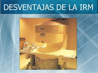 DESVENTAJAS DE LA IRM 