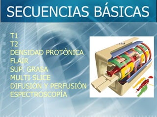 SECUENCIAS BÁSICAS T1 T2 DENSIDAD PROTÓNICA FLAIR SUP. GRASA MULTI SLICE DIFUSIÓN Y PERFUSIÓN ESPECTROSCOPÍA 