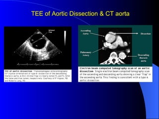 Approach To Patient With Chset Pain | PPT