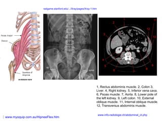 :  www.myoquip.com.au/HipneeFlex.htm 1, Rectus abdominis muscle. 2, Colon 3, Liver. 4, Right kidney. 5, Inferior vena cava. 6, Psoas muscle. 7, Aorta. 8, Lower pole of the left kidney. 9, Left colon. 10, External oblique muscle. 11, Internal oblique muscle. 12, Transversus abdominis muscle.  www.info-radiologie.ch/abdominal_ct.php radgame.stanford.edu/.../Xray/pages/Xray-1.htm 
