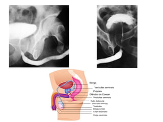 Bexiga Vesículas seminais Próstata Glândula de Cowper Vesículas seminais Duto deferente Vesículas seminais Testículos Bolsa escrotal Cospo esponjoso Corpo cavernoso 