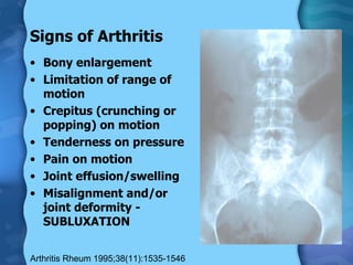 Signs of Arthritis Bony enlargement Limitation of range of motion Crepitus (crunching or popping) on motion Tenderness on pressure Pain on motion Joint effusion/swelling Misalignment and/or joint deformity - SUBLUXATION Arthritis Rheum 1995;38(11):1535-1546 