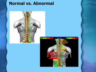 Normal vs. Abnormal 