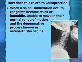 How does this relate to Chiropractic? When a spinal subluxation occurs, the joints become stuck or immobile, unable to move in their normal range of motion  and the degenerative  process known as  osteoarthritis begins… 