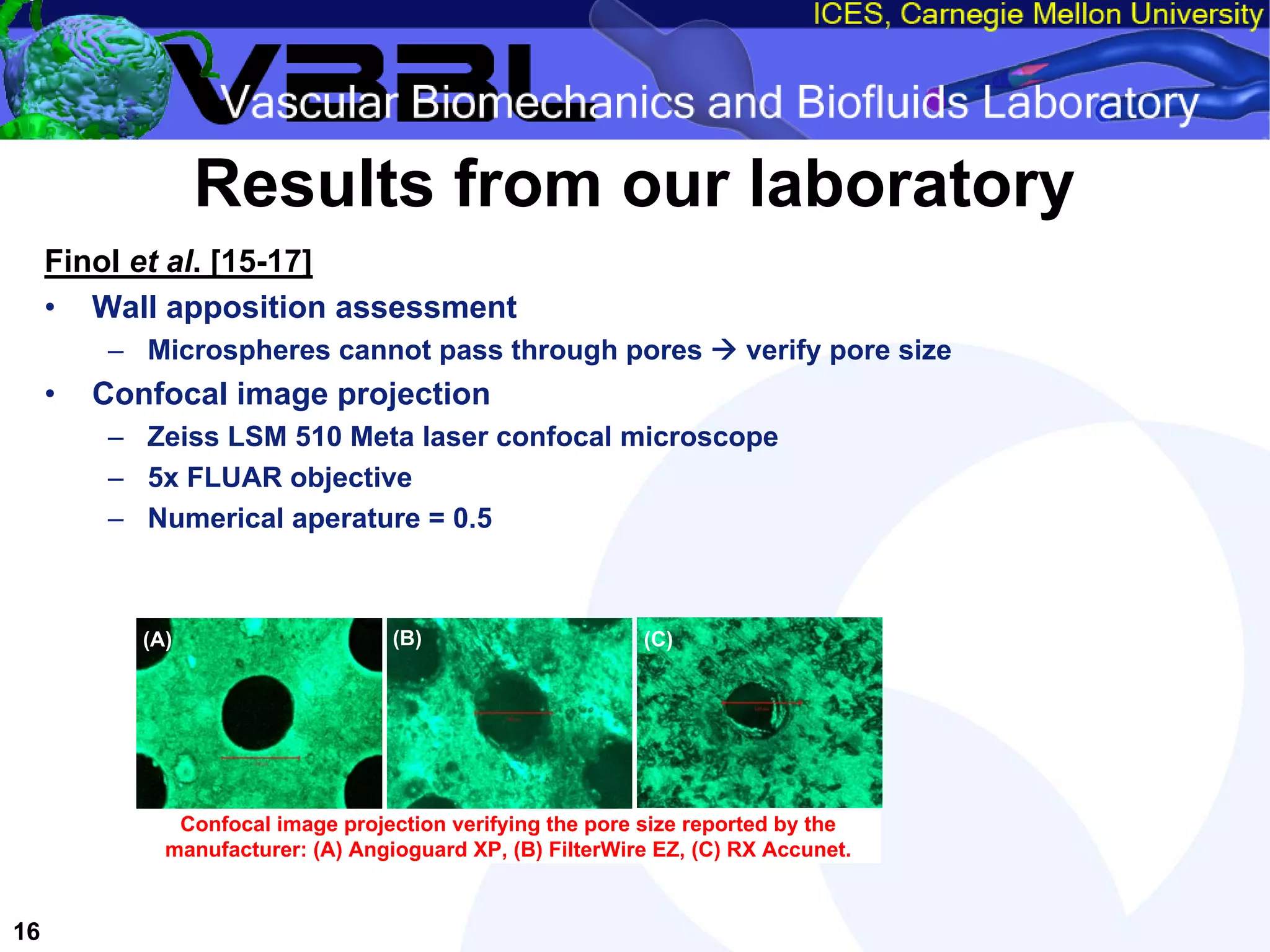 An Overview of Filter-Protected Carotid Artery Stenting