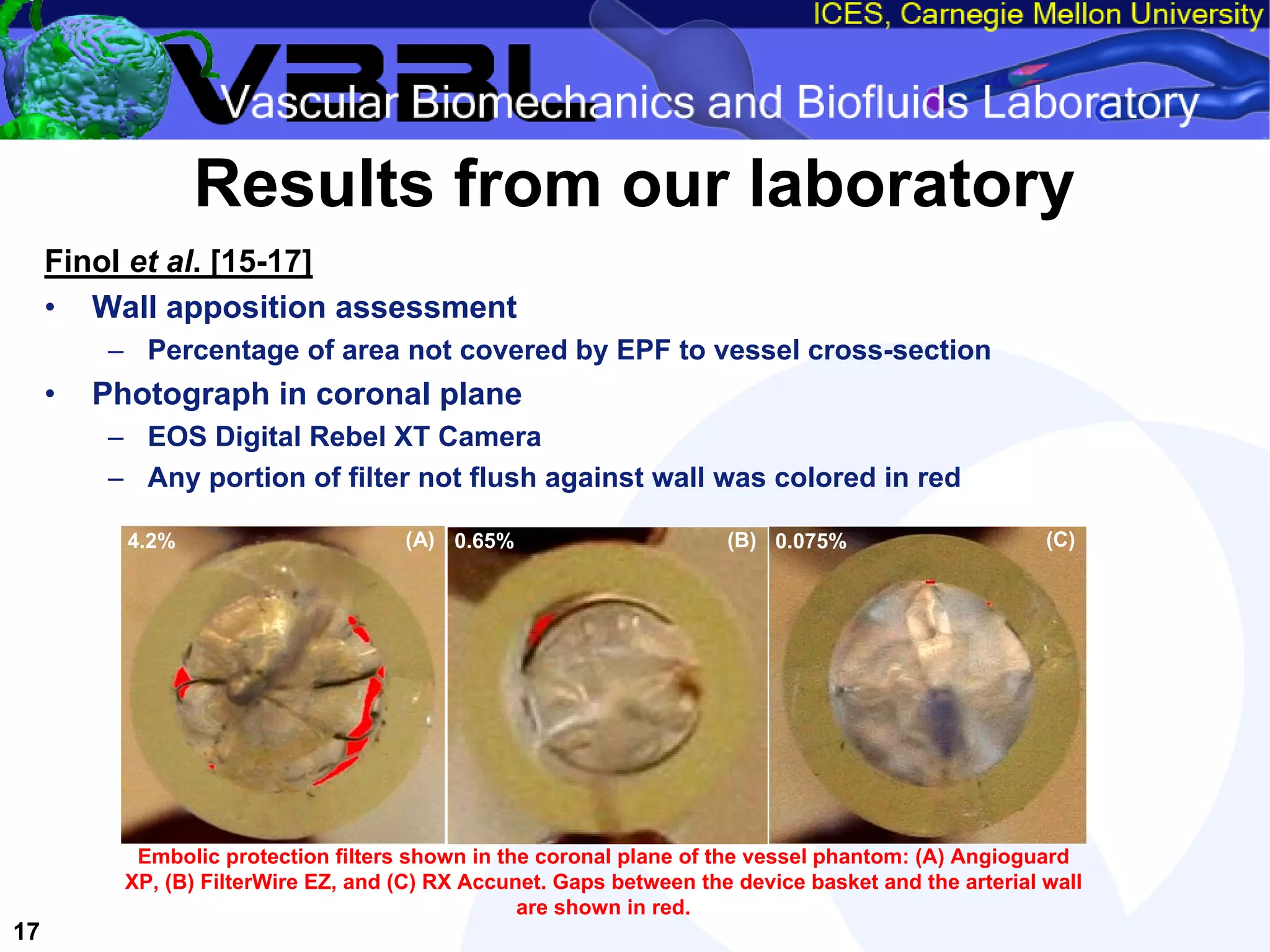 An Overview of Filter-Protected Carotid Artery Stenting