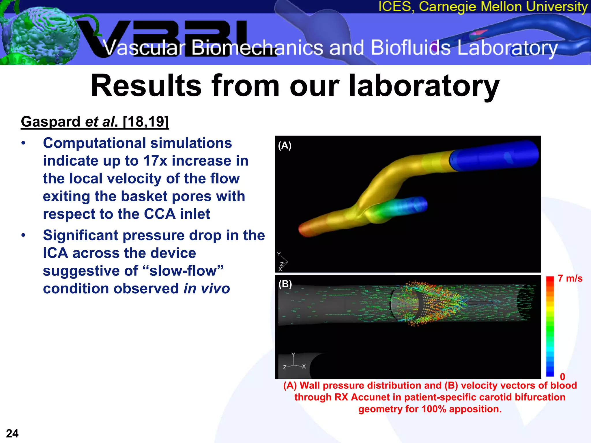 An Overview of Filter-Protected Carotid Artery Stenting