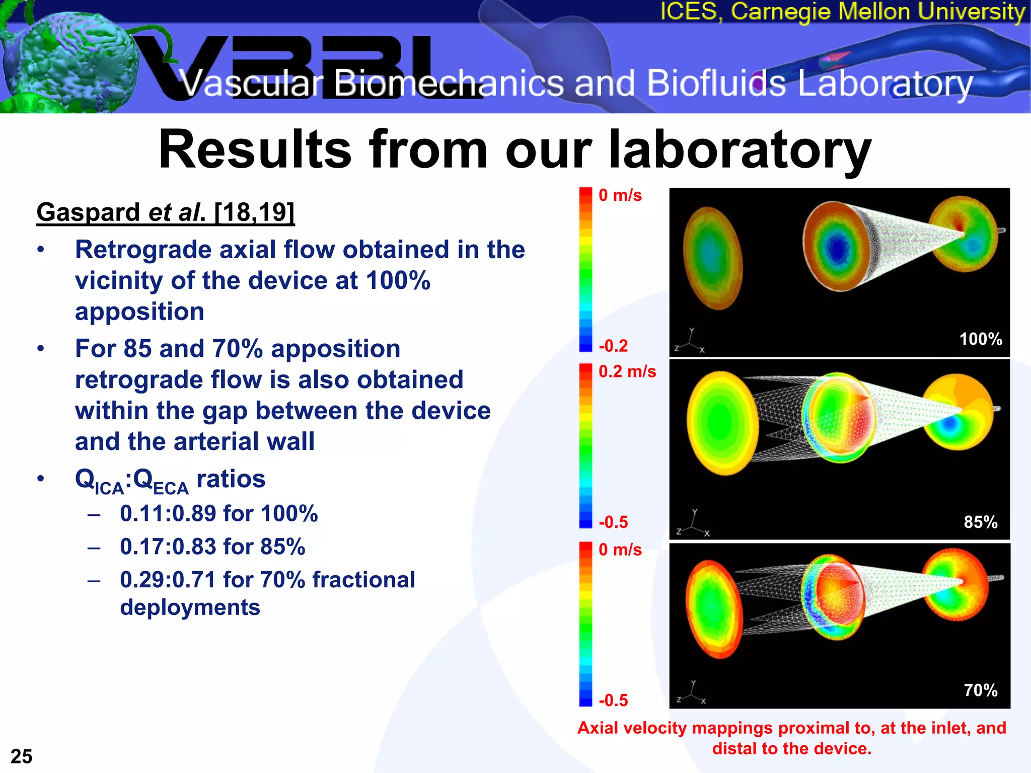An Overview of Filter-Protected Carotid Artery Stenting