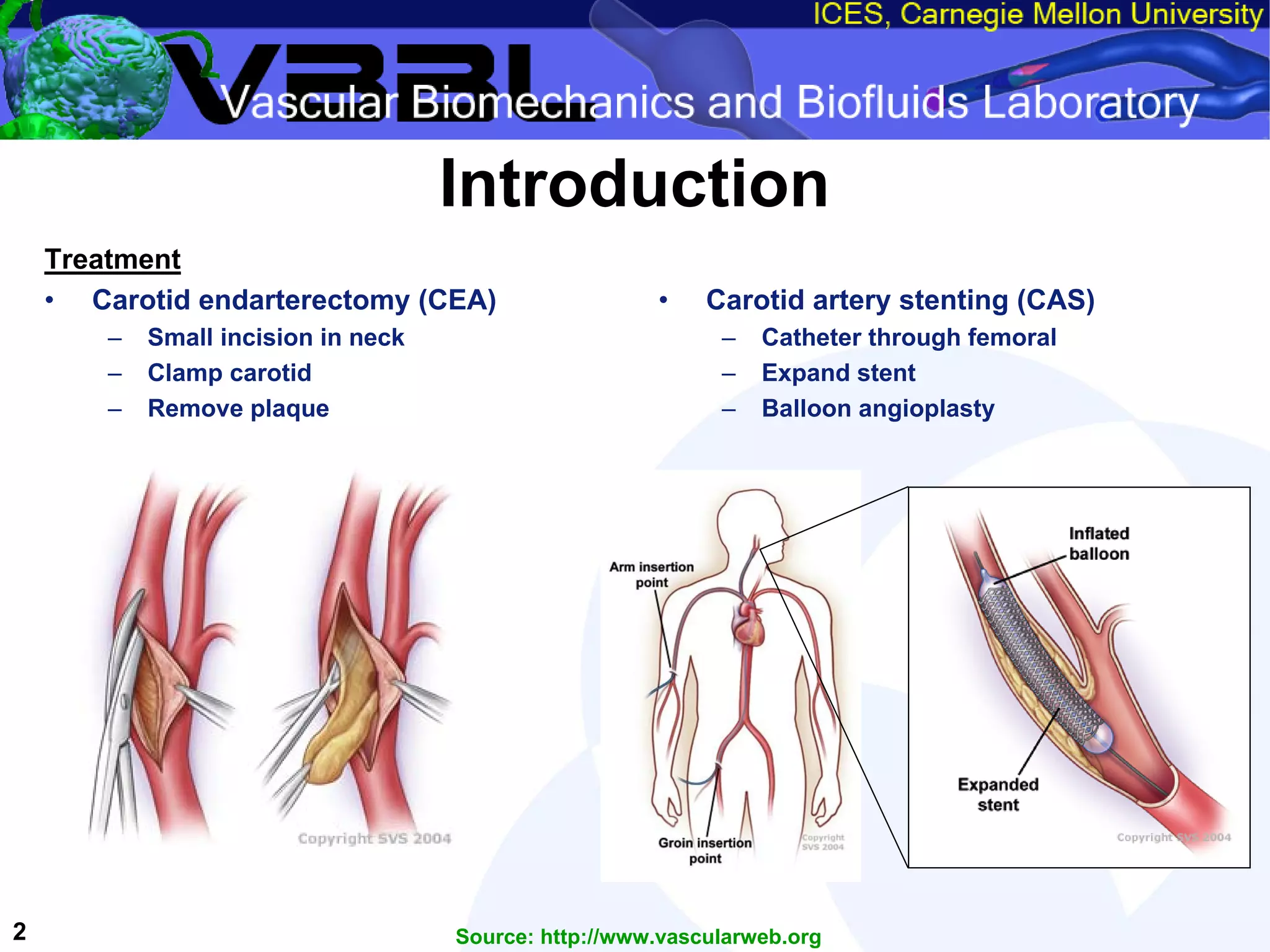 An Overview of Filter-Protected Carotid Artery Stenting